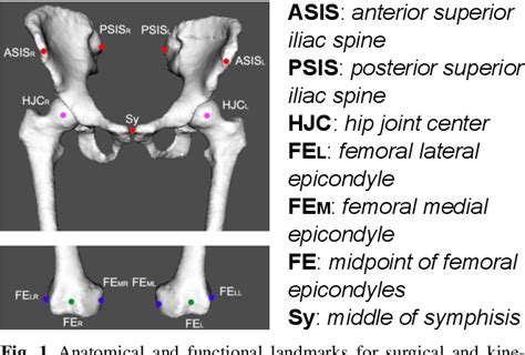 psis medical meaning